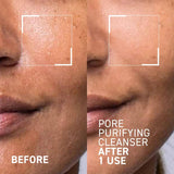 Dr. Brandt Pores No More Pore Purifying Cleanser