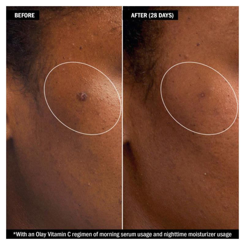 Olay Vitamin C + Peptide 24 Brightening Serum-1.3 oz / 40 m Olay Vitamin C + Peptide 24 Brightening Serum-1.3 oz / 40 m