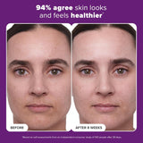 Paula's Choice 1% Retinol Treatment