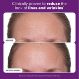 Paula's Choice 1% Retinol Treatment