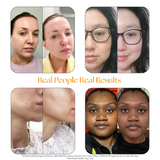 HAIRtamin SKINtamin® | Vitamin for Skin Health & Collagen Support