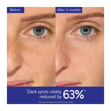 Caudalie Brightening Dark Spot Serum Vitamin C Alternative 30ml