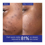 Caudalie Brightening Dark Spot Serum Vitamin C Alternative 30ml