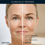 RoC Retinol Correxion Line Smoothing Eye Cream (15 ml)