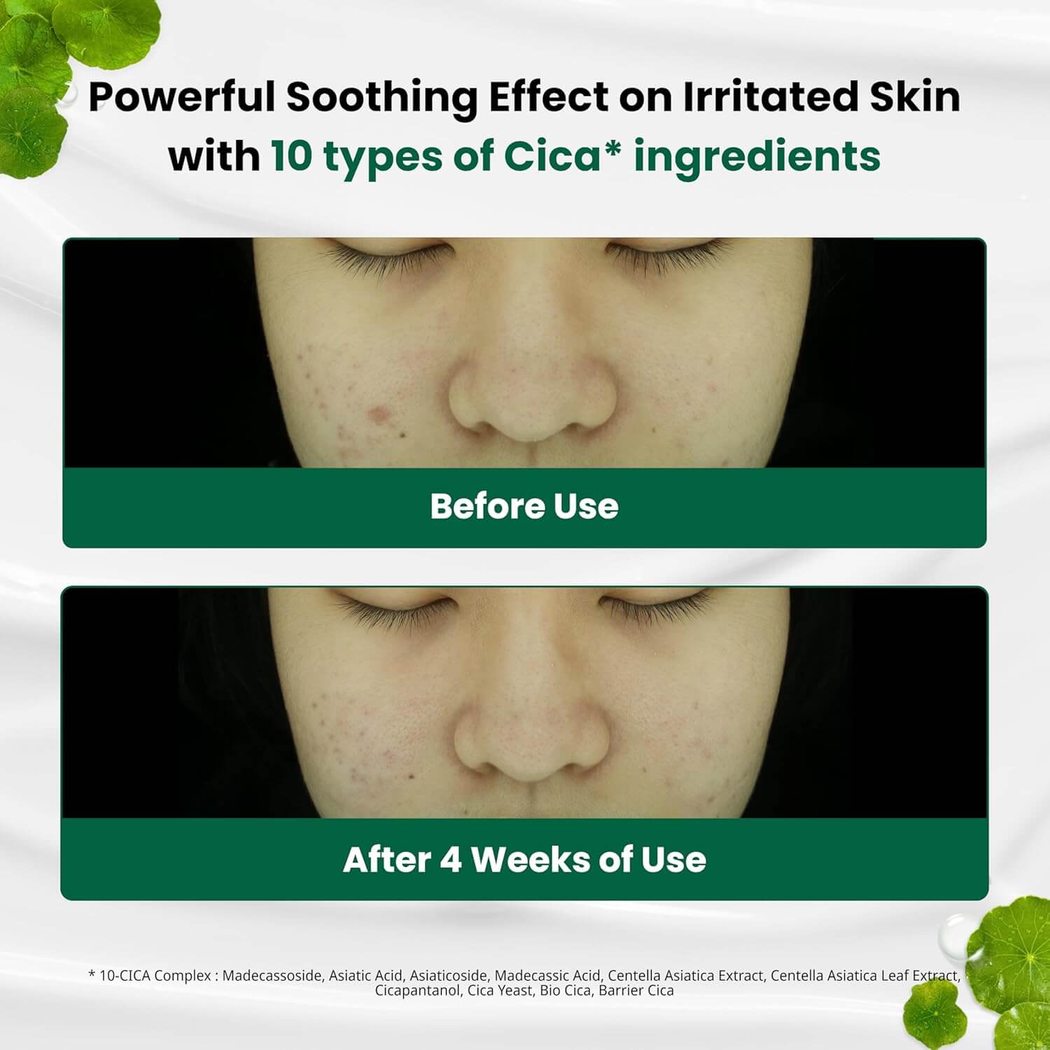 DR.G R.E.D BLEMISH CLEAR SOOTHING CREAM