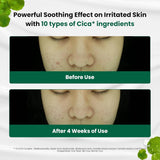 DR.G R.E.D BLEMISH CLEAR SOOTHING CREAM
