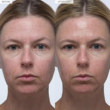 Glow Recipe Plum Plum Hyaluronic Acid Serum