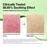 Anua Azelaic 10% + Hyaluron Redness Soothing Pad