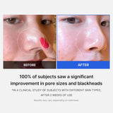 Medicube – Zero Pore Pad 2.0