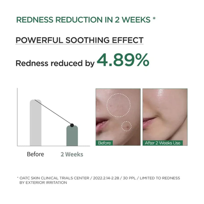 Anua Houttuynia Cordata 80% Moisture Soothing Ampoule