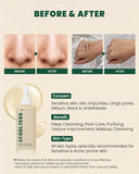 KSecret Seoul1988 Cleansing Oil Pine Cica 1% +Probiotics