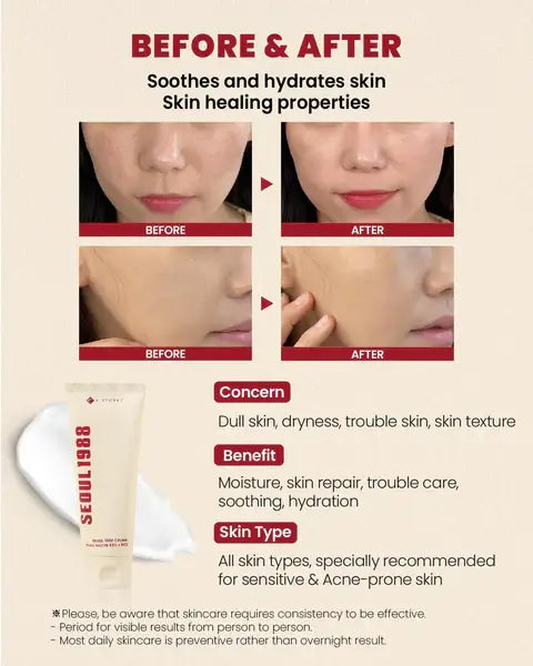 K-Secret – Seoul 1988 Snail Mucin 93% + Rice Cream