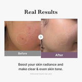 Medicube- Age-r Glutathione Glow Toner - 140ml