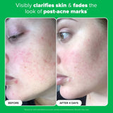 Paula's Choice 10% Azelaic Acid Booster 30ml