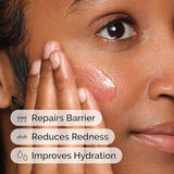 The Ordinary Soothing & Barrier Support Serum